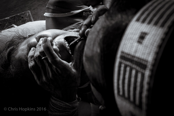 MENTAWAI TEETH SHARPENING RITUAL